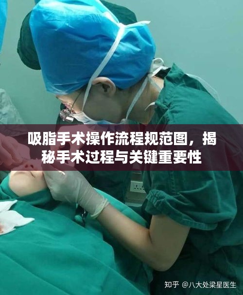 吸脂手术操作流程规范图，揭秘手术过程与关键重要性