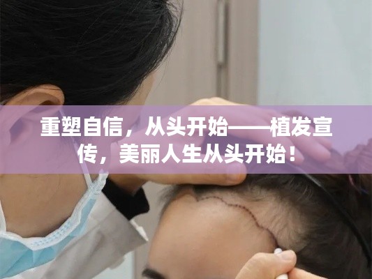 重塑自信,从头开始——植发宣传,美丽人生从头开始!